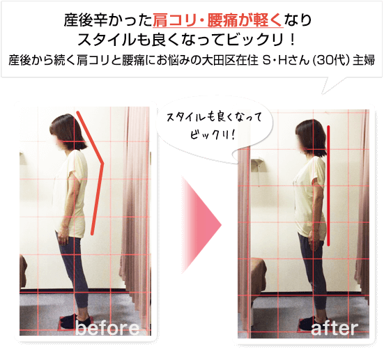 東京都大田区在住のS・Hさんの声。産後辛かった肩コリや腰痛が、施術後は軽くなりスタイルも良くなってビックリ!