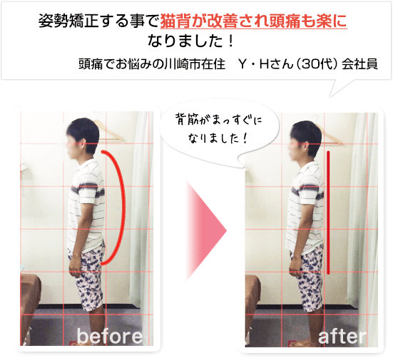 川崎市在住のY・Hさんの声。姿勢矯正する事で猫背が改善され頭痛も楽になりました!